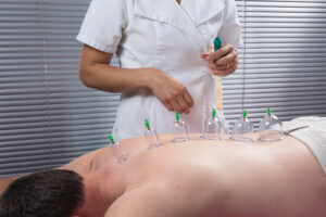 Therapist performing cupping therapy on a patient’s back.