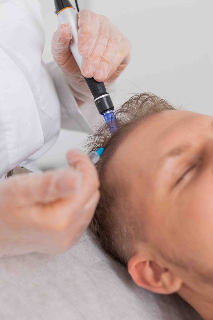 Man getting PRP therapy for hair.